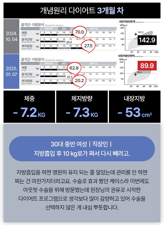 관리